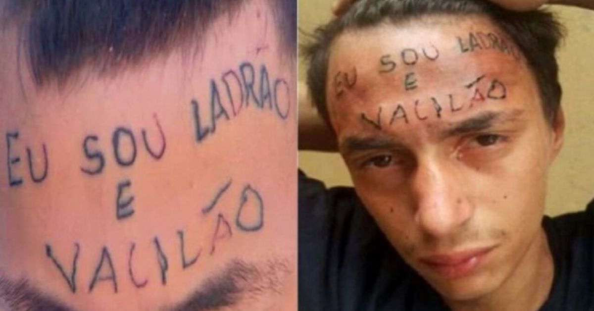 O jovem não conseguiu se recuperar bem e permanece preso.