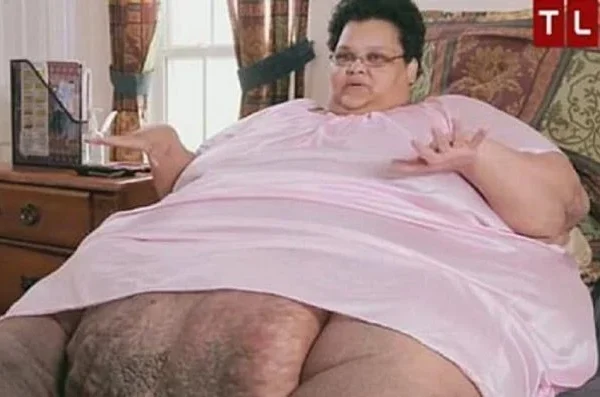 A história de Mila Clark. Ela perdeu muito peso e atualmente está irreconhecível.